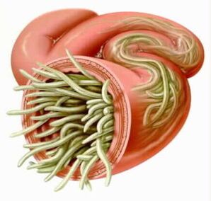 Paraziți în intestine
