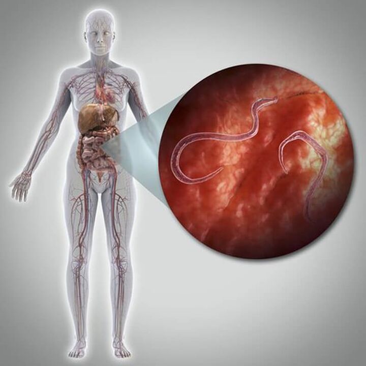 Paraziți în corpul unei persoane