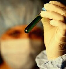 cum să fii testat pentru paraziți